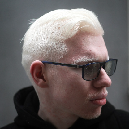Albino - Blagoslovi 